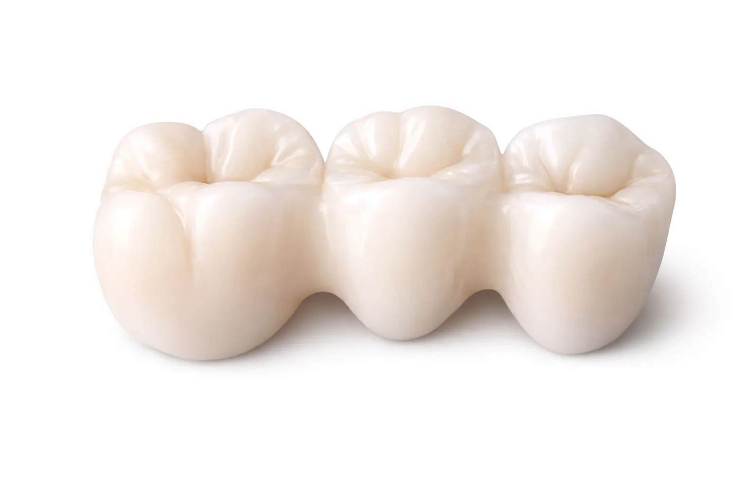 Protesi dentale a Milazzo